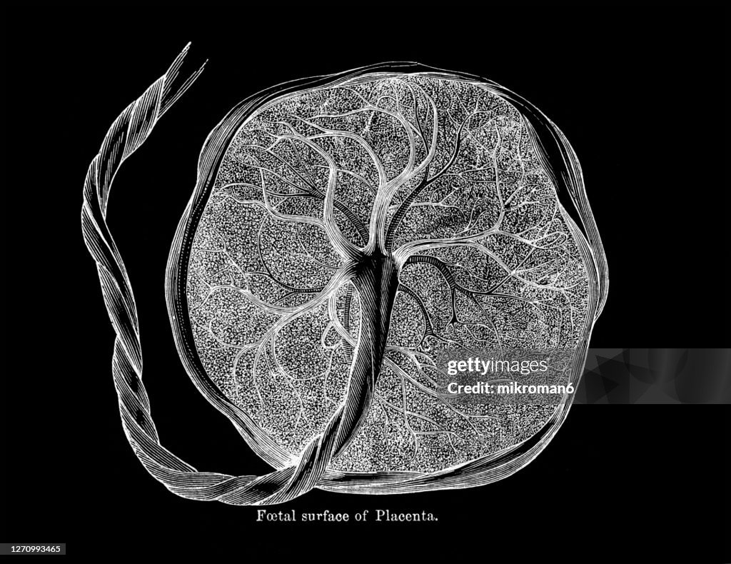 Old engraved illustration of The Human placenta, Foetal surface of Placenta.