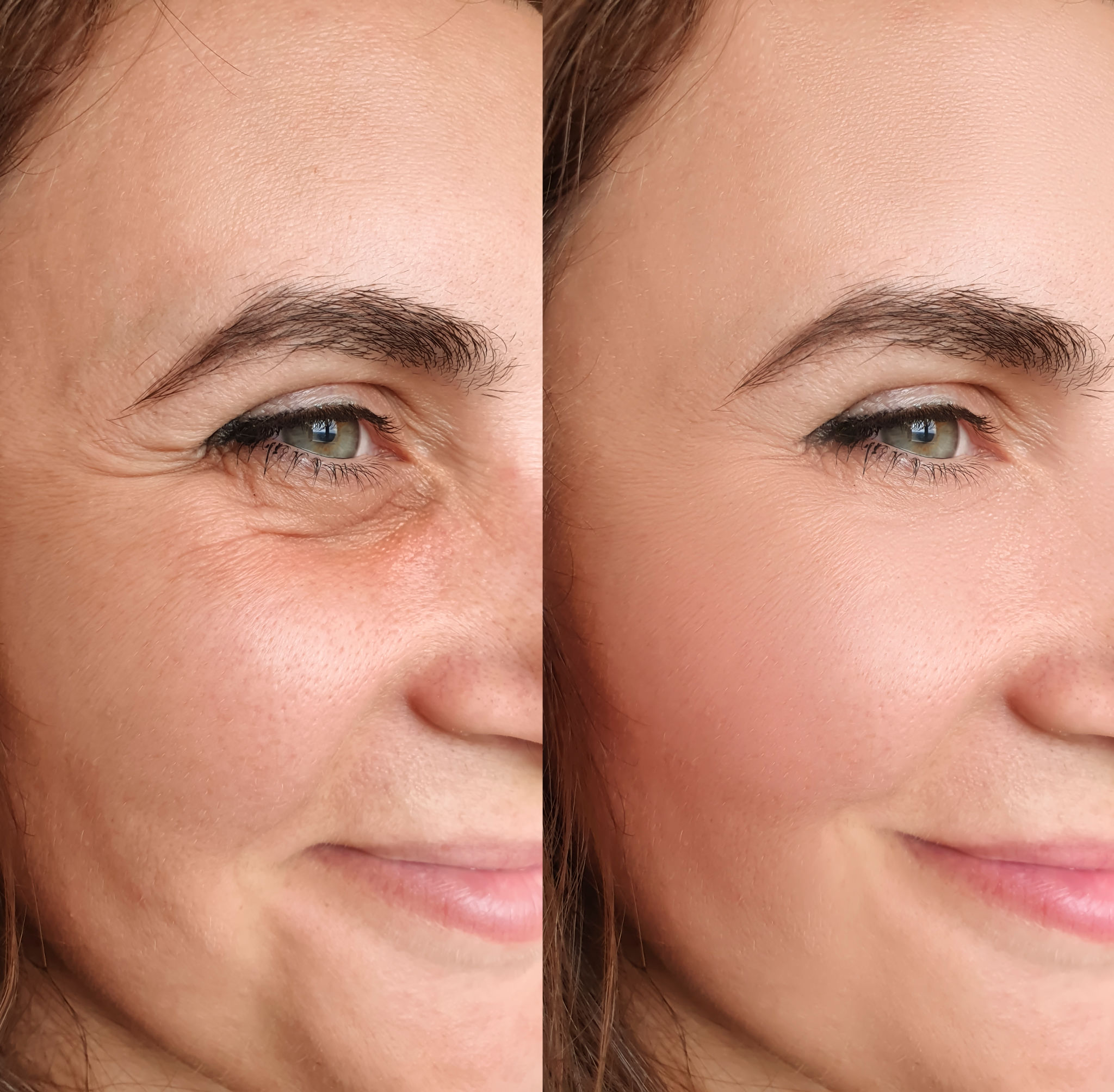 before and after treatment