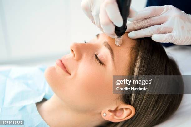 dermapen skin needling treatment - aesthetics beauty stock pictures, royalty-free photos & images