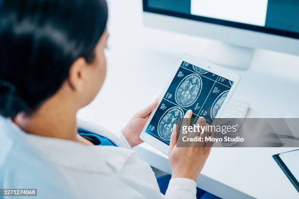彼女は脳の病気の治療の専門家です - brain computer ストックフォトと画像
