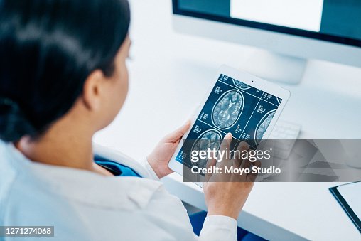 She's a specialist at treating diseases of the brain She's a specialist at treating diseases of the brain