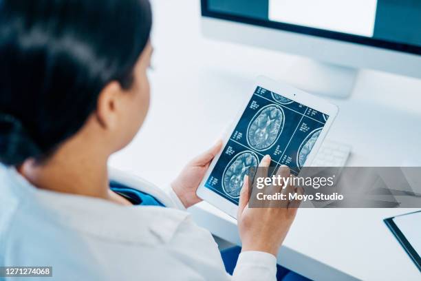 她是治療腦部疾病的專家。 - radiologist 個照片及圖片檔