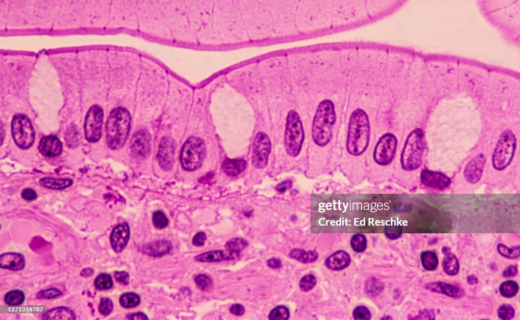 Epitheliumsimple Columnar Epithelium Lining The Small Intestine 250x ...