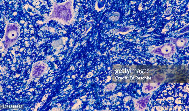 motor neuron cell bodies (anterior horn cells) with numerous nissl bodies (or chromatophilic substance), spinal cord, 100x - spinal neuron imagens e fotografias de stock