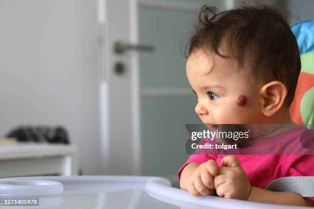 hemangioma on the face of a baby - endothelial function stock pictures, royalty-free photos & images