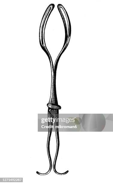 old engraved illustration of hodge's obstetrical forceps - obstetric forceps stock pictures, royalty-free photos & images