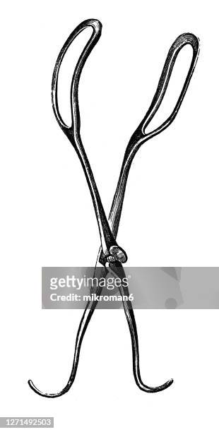 old engraved illustration of hodge's obstetrical forceps - obstetric forceps stock pictures, royalty-free photos & images