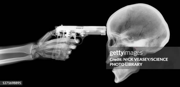 gun and skeleton, x-ray - 極刑 ストックフォトと画像