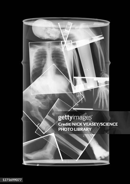 oil drum skeleton, x-ray - rib cage bildbanksfoton och bilder