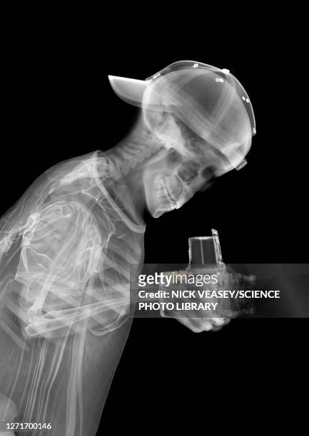 skeleton photographer, x-ray - radiogram photographic image stock-fotos und bilder