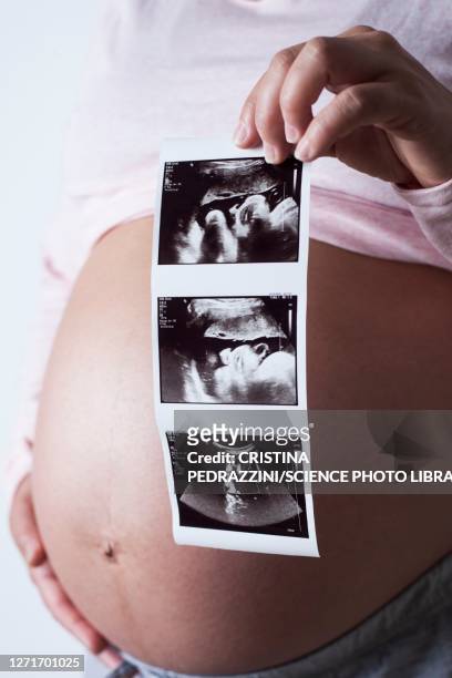 pregnant woman holding baby scans - 8 month pregnant stock pictures, royalty-free photos & images