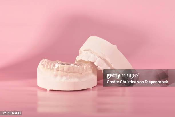 professional splint on plaster model - bruxism stockfoto's en -beelden