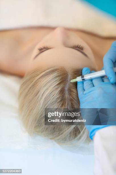 tratamiento de inyección capilar prp - plasma rico en plaquetas fotografías e imágenes de stock