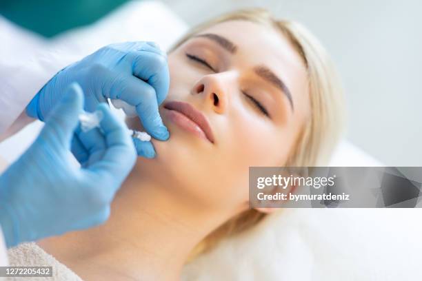 cosmetic injection of botox - lip injections stock pictures, royalty-free photos & images