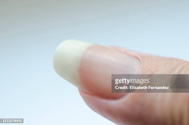 finger female hand - nagelhaut stock-fotos und bilder
