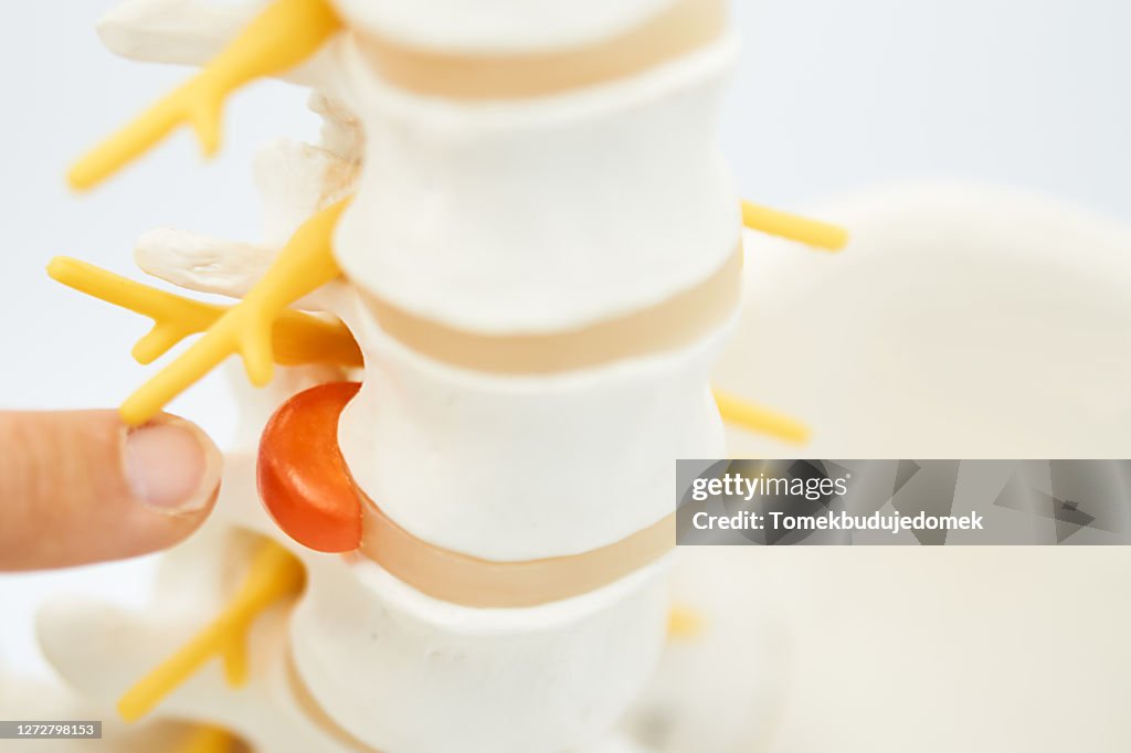 Spine