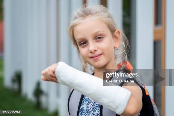 broken arm - knochenbruch stock-fotos und bilder