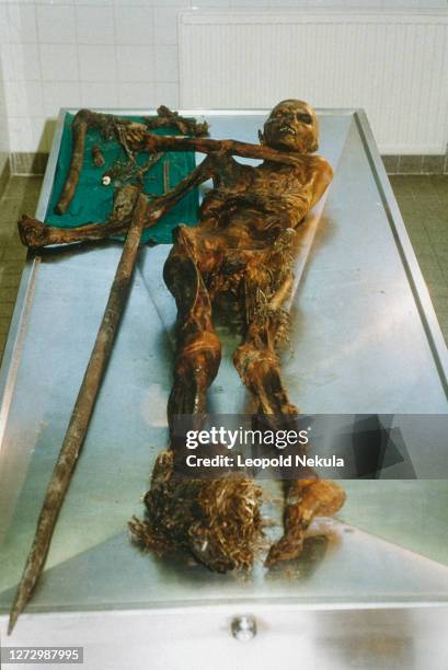 Le corps momifié découvert sur le glacier Similaun à l'institut médico-légal d'Innsbruck.