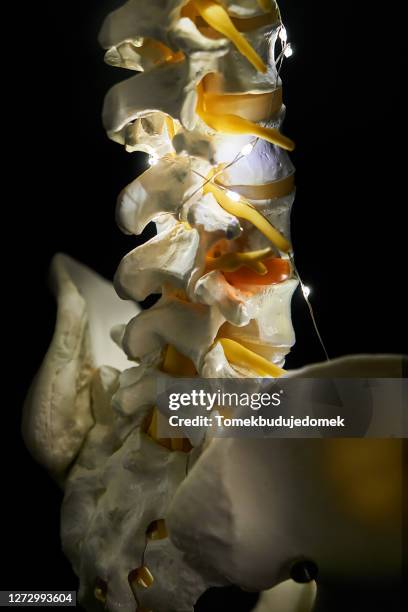 spine - espondilitis anquilosante fotografías e imágenes de stock