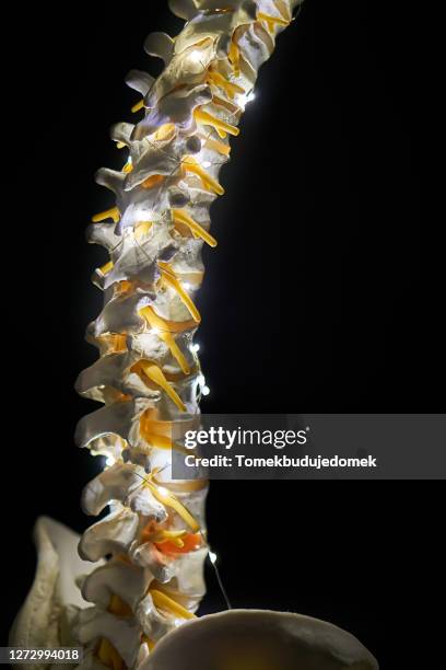 spine - ankylosing spondylitis stock pictures, royalty-free photos & images