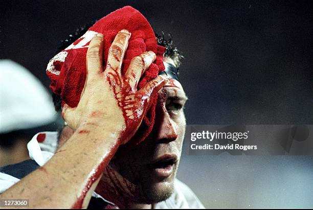 Phil Kearns of Australia holds a cloth to his head injury during the Tri-Nations match against South Africa at the Subiaco Oval in Perth, Australia....