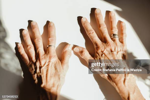 senior woman hands - gelenkrheumatismus stock-fotos und bilder