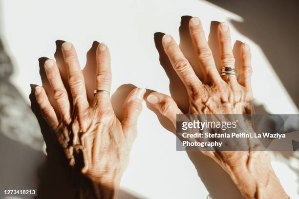 senior woman hands - arthritis hands photos et images de collection