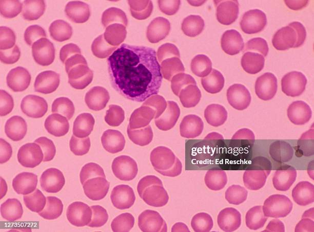 Monocyte Rbc 100 Monocyte Macrophage Stock Photos, High-Res Pictures, and Images ...