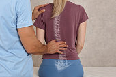 Scoliosis Spine Curve Anatomy, Posture Correction. Chiropractic treatment, Back pain relief.
