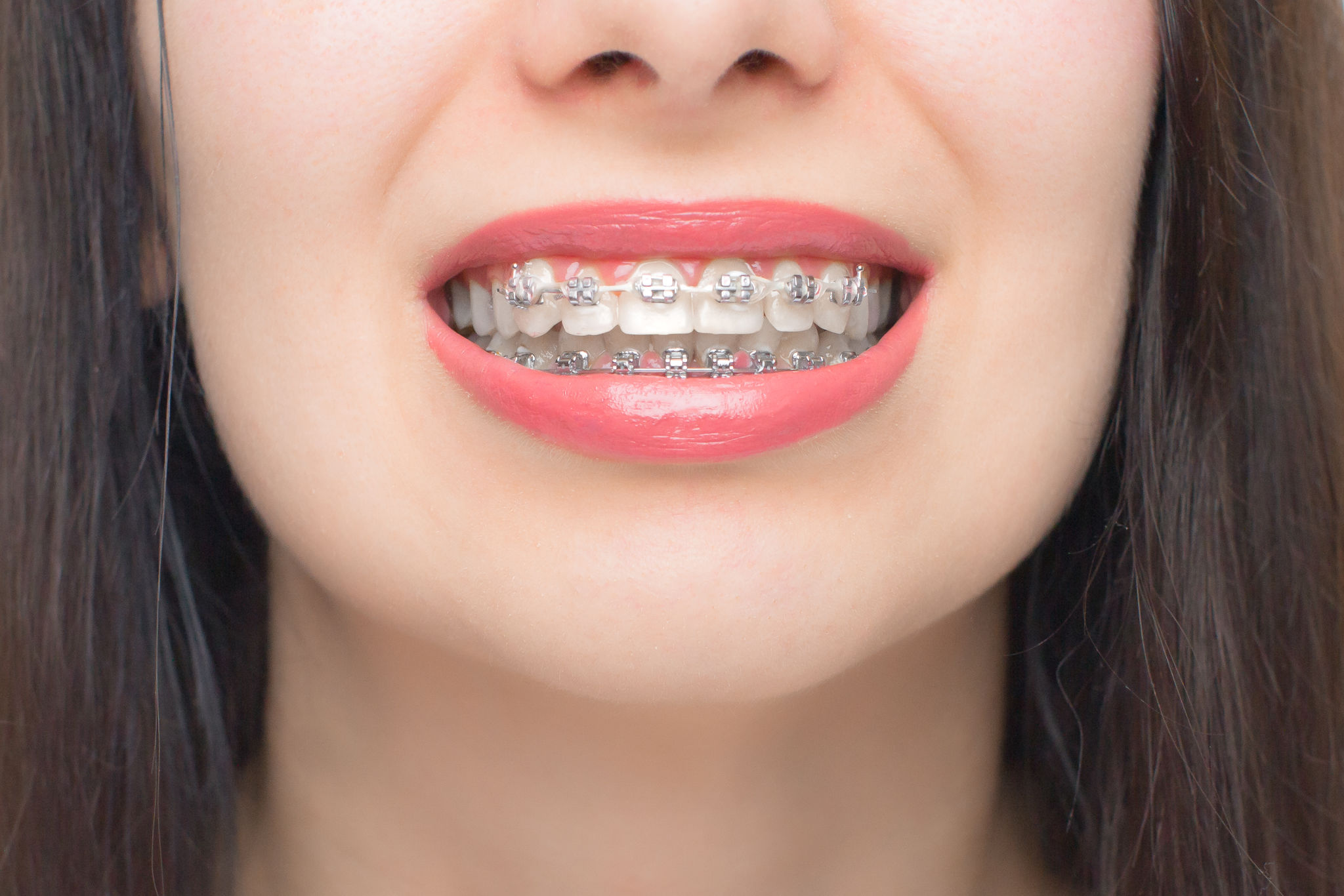 orthodontic treatment timeline