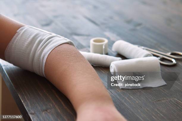 child arm wrapped with bandage for first aid - bandage stock pictures, royalty-free photos & images