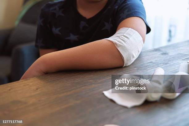 child arm wrapped with bandage for first aid - wrapping arm stock pictures, royalty-free photos & images