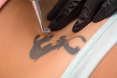 Laser tattoo removal procedure. Salon equipment
