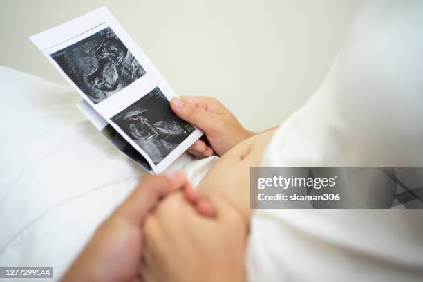 young female pregnant and holding husband hand and see piture of ultrasound newlife baby - ultraljud bildbanksfoton och bilder