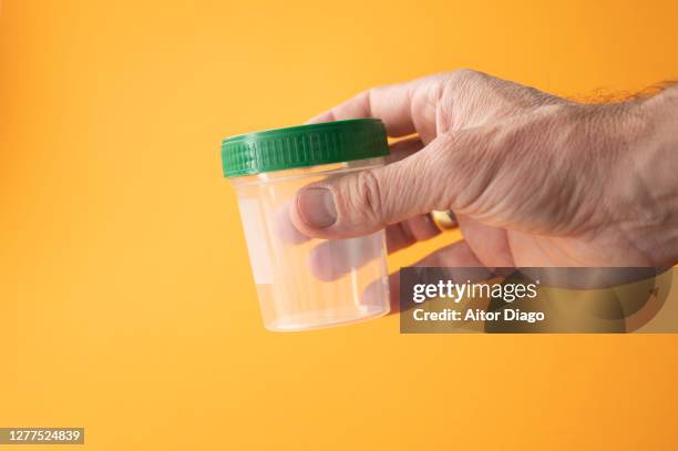 man holding an empty urine sample tube in his hand. - medical sample - fotografias e filmes do acervo