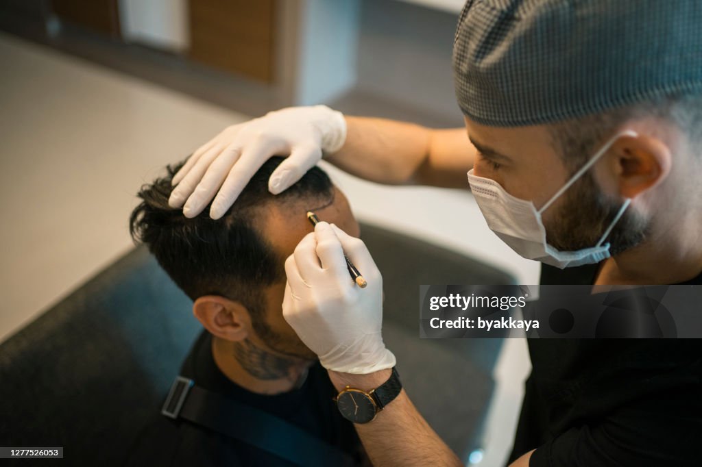 Hair transplant