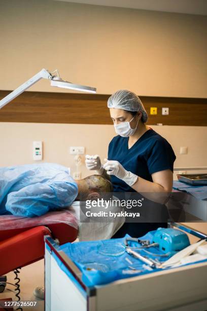 haartransplantation - haartransplantation stock-fotos und bilder