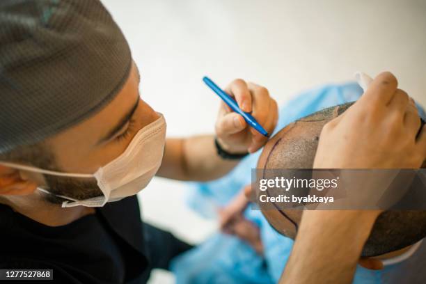 hair transplant - transplant surgery stock pictures, royalty-free photos & images