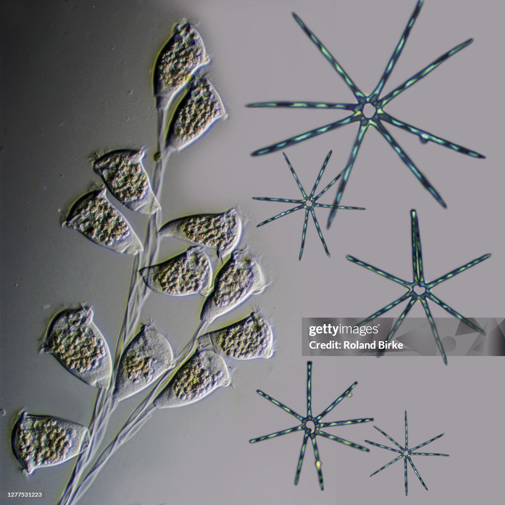 Vorticella protozoan and Diatoms