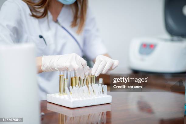 tragen von schutzhandschuhen und einsetzen von urinproben in schläuche im rack - urine sample stock-fotos und bilder