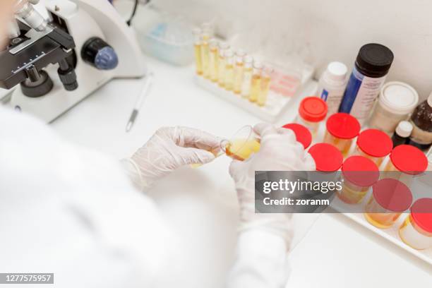 hands in gloves pouring urine sample into test tube - urine sample stock pictures, royalty-free photos & images