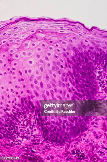 stratified squamous epithelium from the palatine tonsil, 100x - plaveiselcelepitheel stockfoto's en -beelden