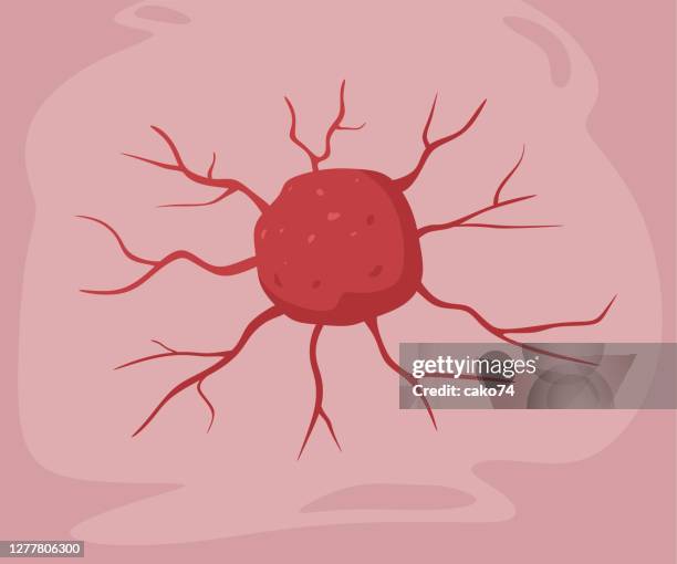 illustrazioni stock, clip art, cartoni animati e icone di tendenza di illustrazione del calcio tumorale - cancro tumore
