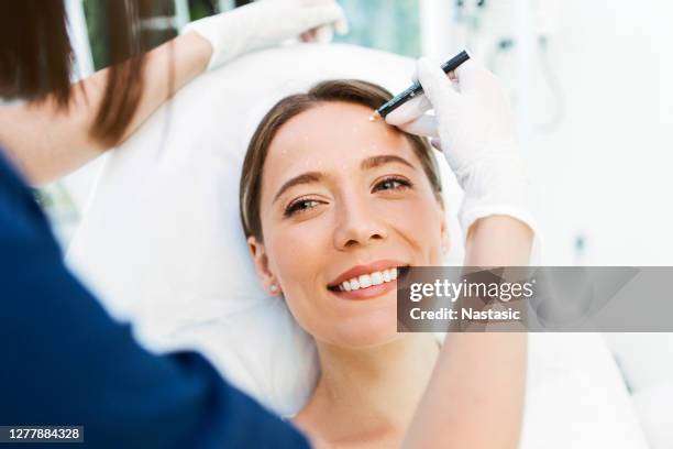 young woman with correction dots on the face in an examination room with doctor - beauty treatment imagens e fotografias de stock