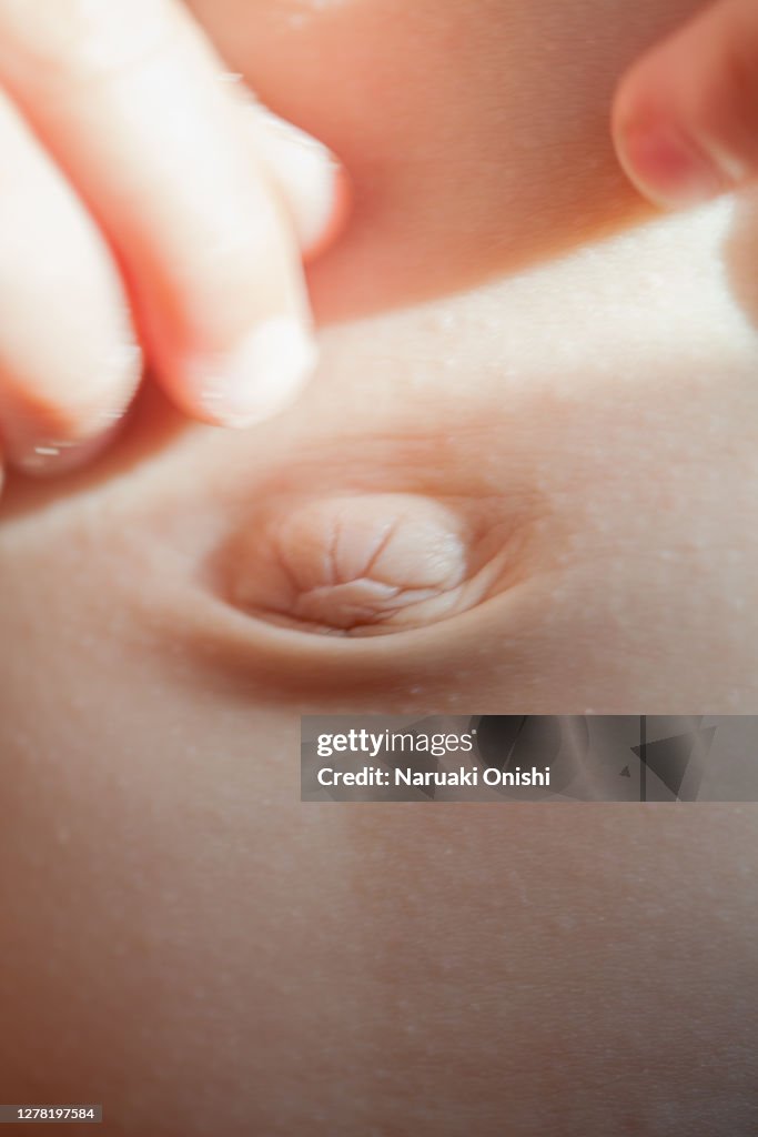Baby navel