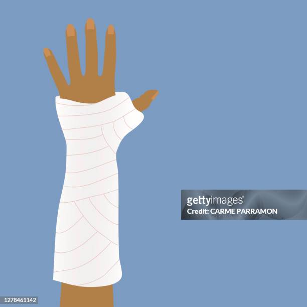 bandages or cast for broken arms. - healing wound stock illustrations