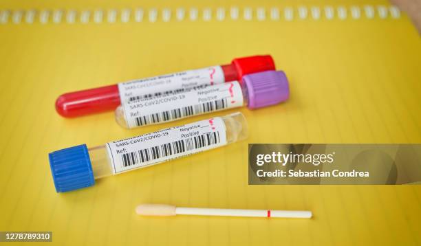 coronavirus covid-19 bood test virus uncertainty (sars-cov-2)and  tests based on swabs from oropharyngeal (op) sampling - chlamydia stock pictures, royalty-free photos & images