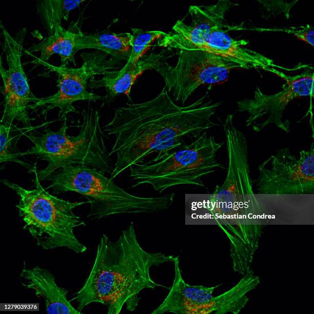mesenchymal stem cells labeled with fluorescent molecules. - microphotographie immunofluorescente photos et images de collection