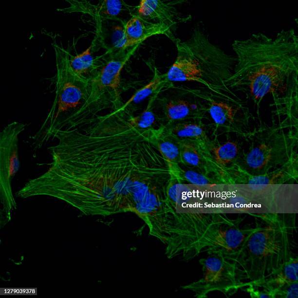incubation of cells with cytostatics, actin filaments(nanotechnology) and morphological changes following chemotherapy using confocal microscopy - microfotografia immunofluorescente foto e immagini stock