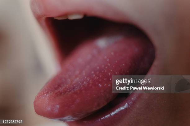 boy with scarlet fever - painful lips stock pictures, royalty-free photos & images